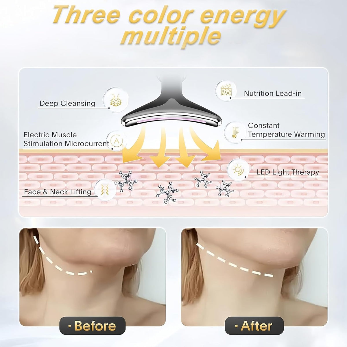 Vegena 3-in-1 EMS Thermal Face & Neck Beauty Massager